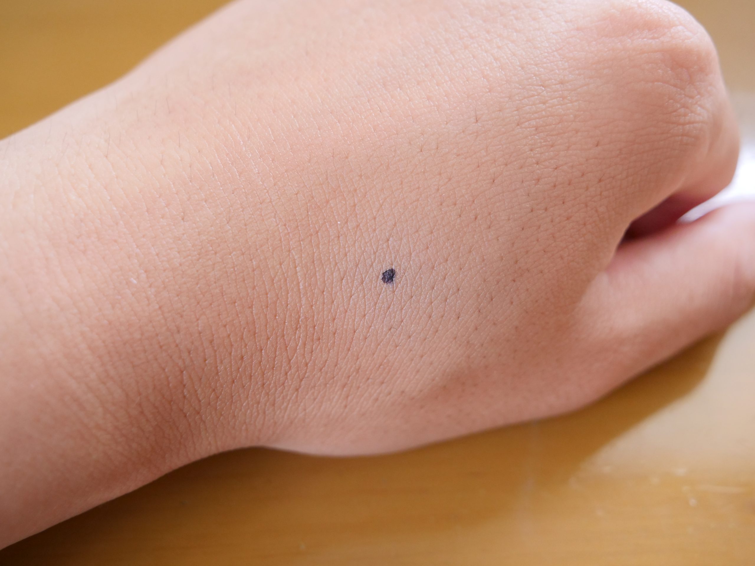 オルビスミスター_コンシーラー_before