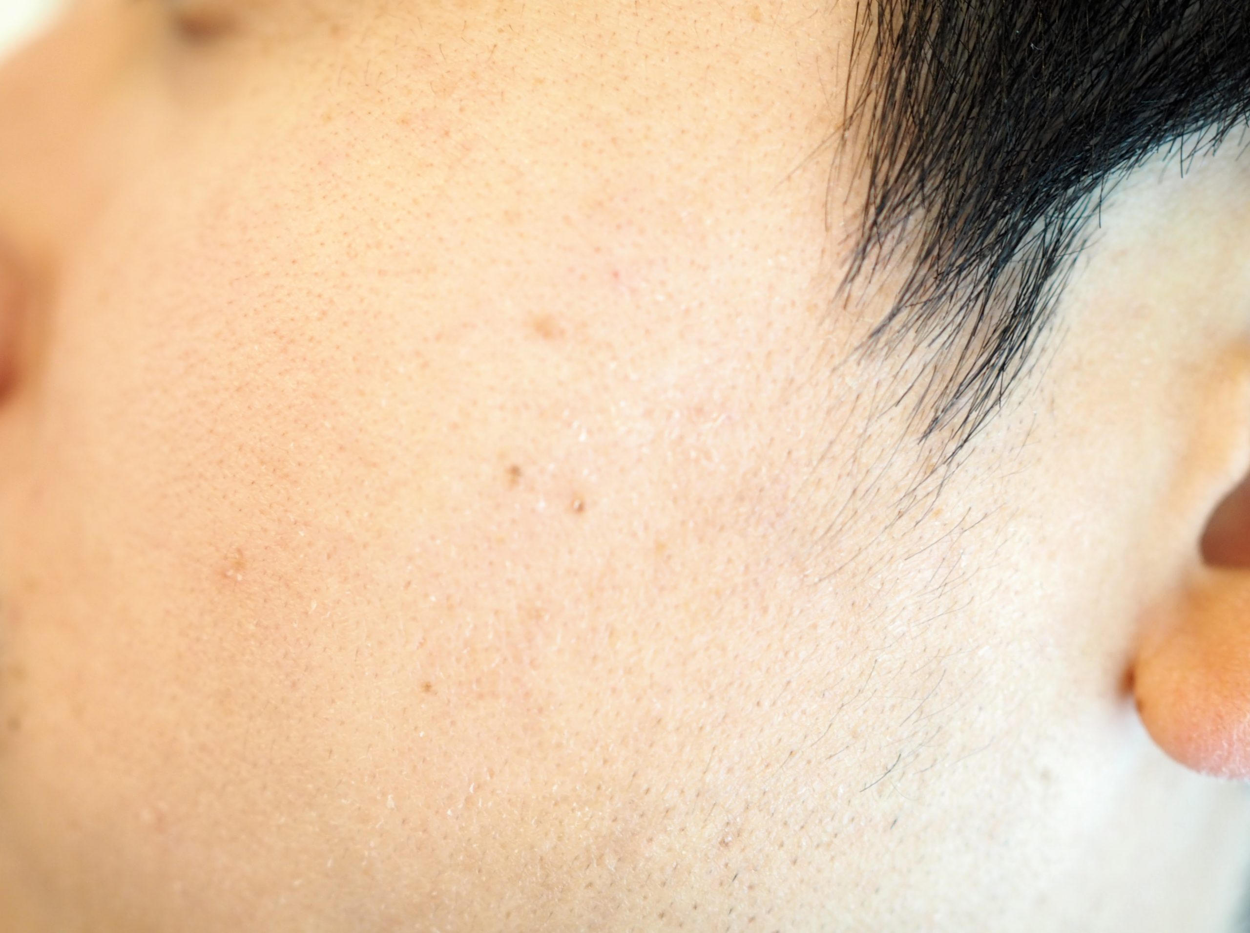 クワトロボタニコ_使用前